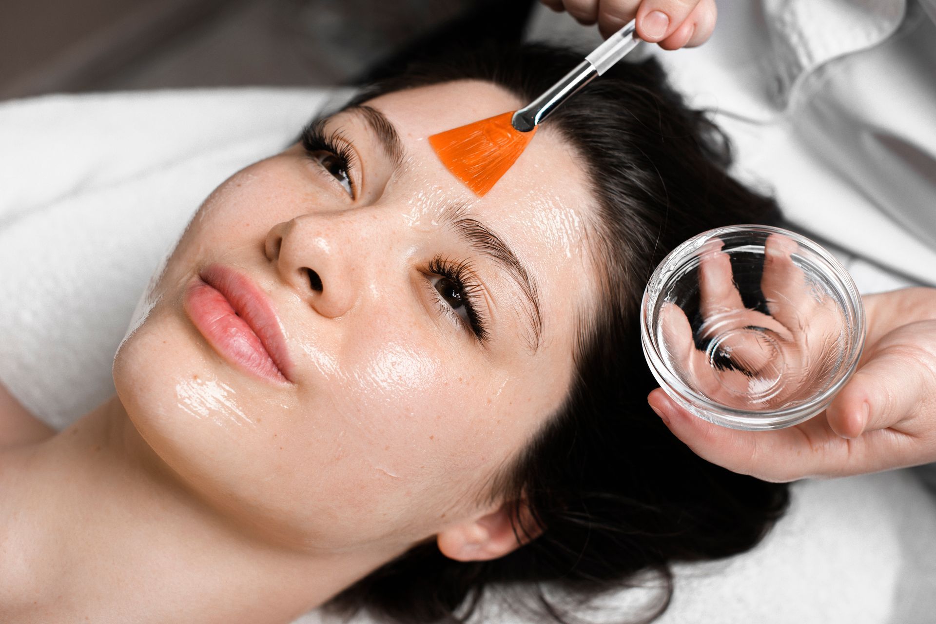 Person receiving chemical peel treatment on forehead with brush and bowl.