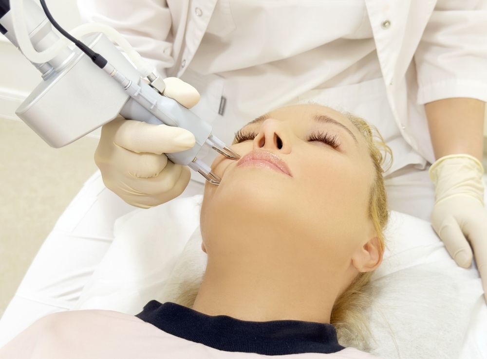 Woman receiving laser treatment on her upper lip, indoors. A gloved hand uses a device on her face.