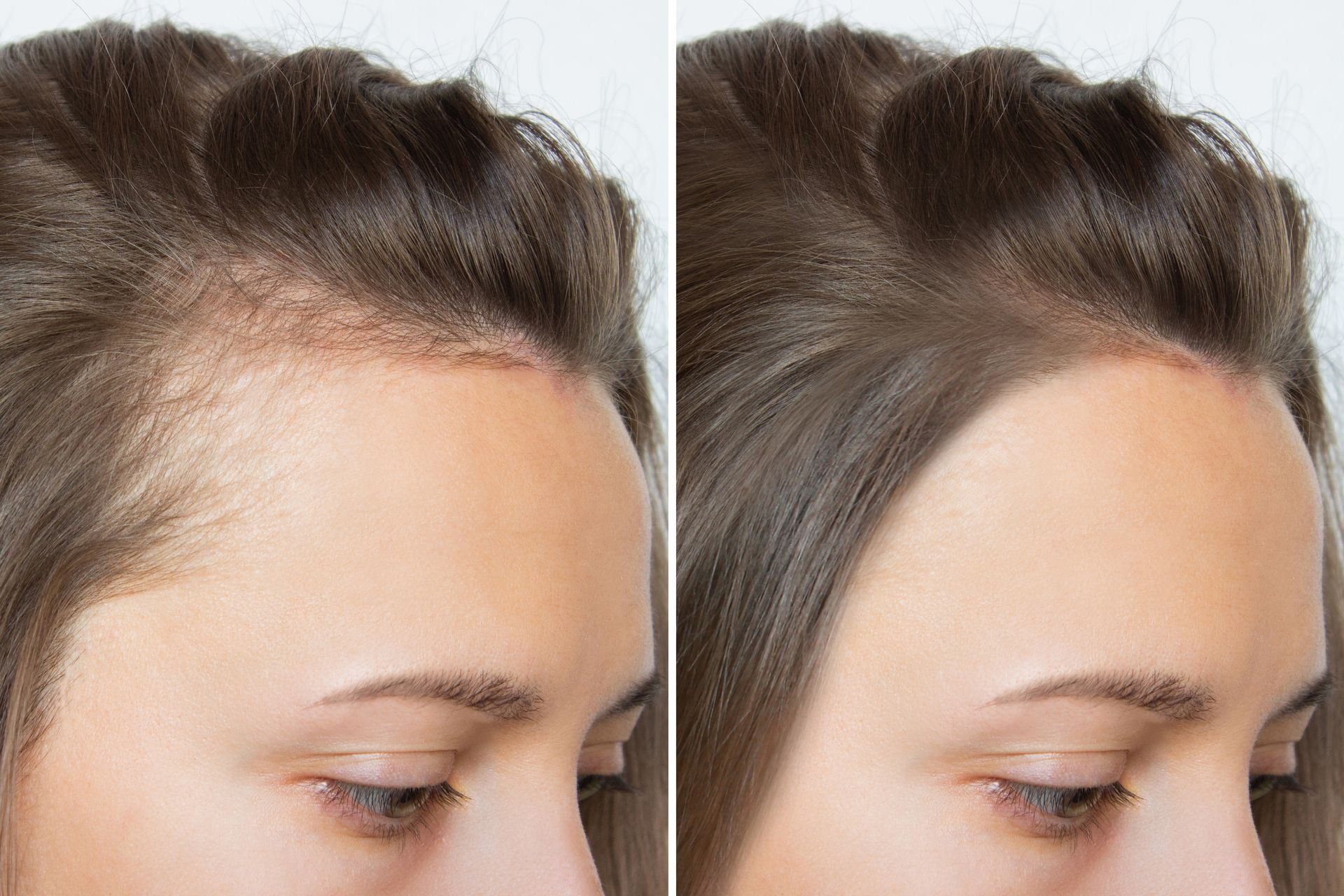 A before and after photo of a woman 's hair growth.