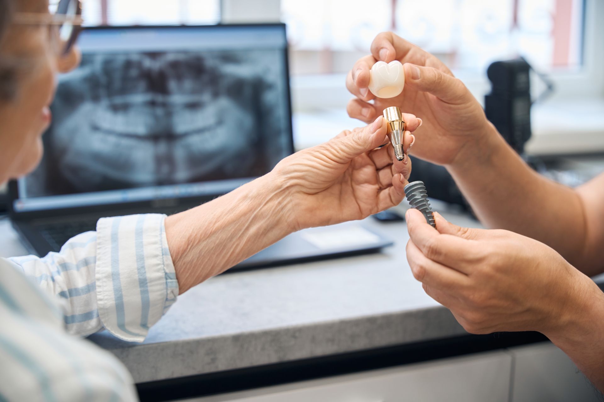 Dentist showing a patient dental implant options. X-ray, teeth models, and patient in an office setting.