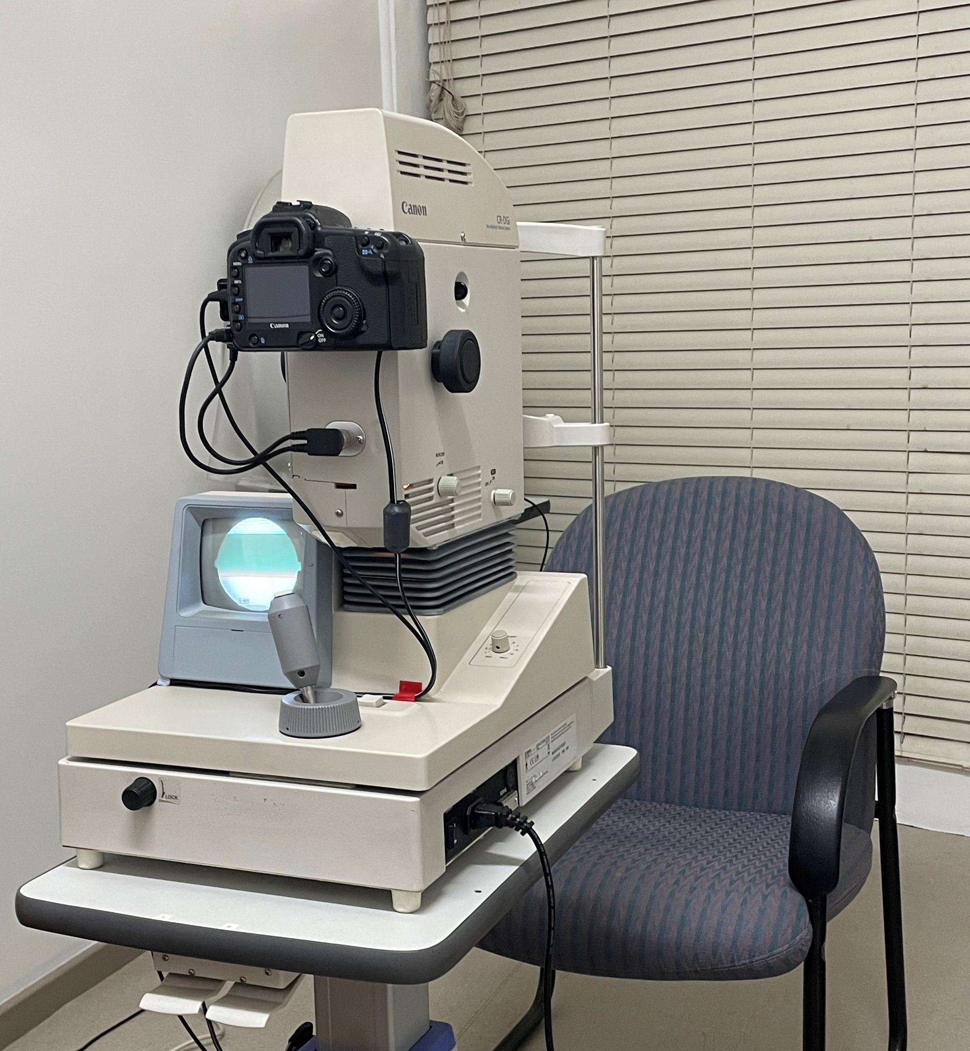 Closeup Retinal Photo Machine— Optometrist in Wallsend, NSW