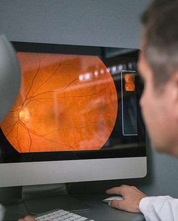 Retina photo displayed on desktop— Optometrist in Wallsend, NSW