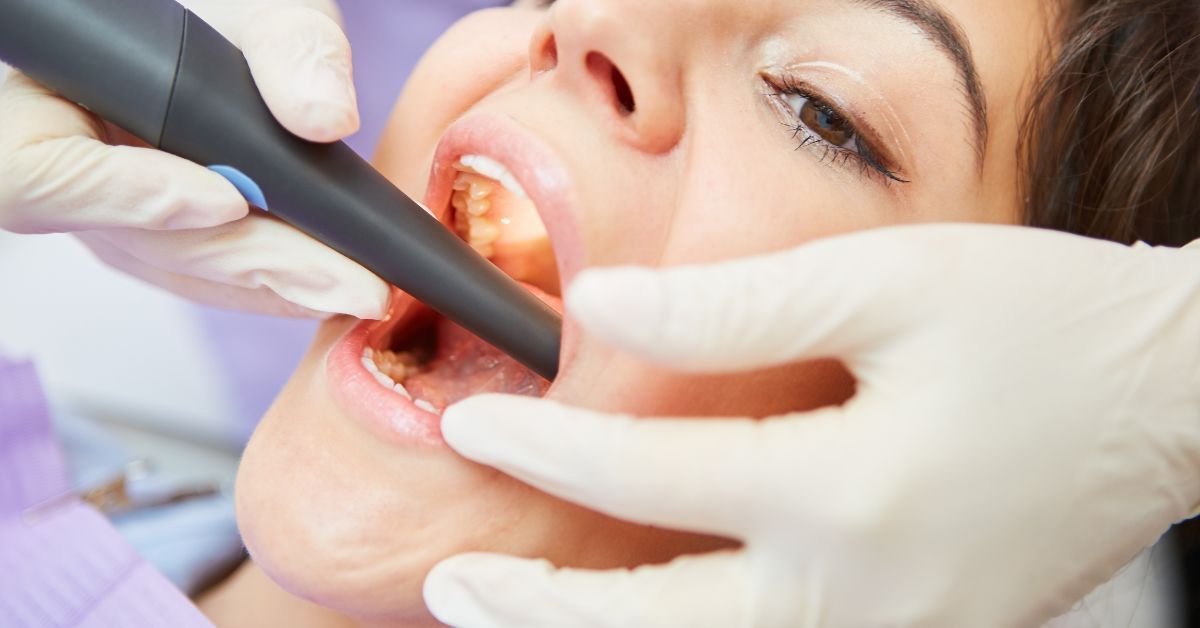 Root Canal Treatment Glen Carbon il