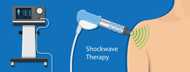 Extracorporeal Shockwave Therapy ESWT Now Available