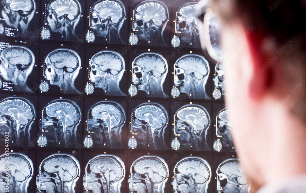 A man is looking at a mri of a person 's brain.