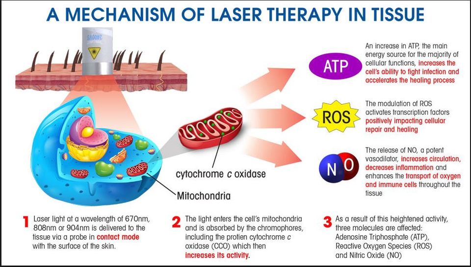 iv laser light therapy