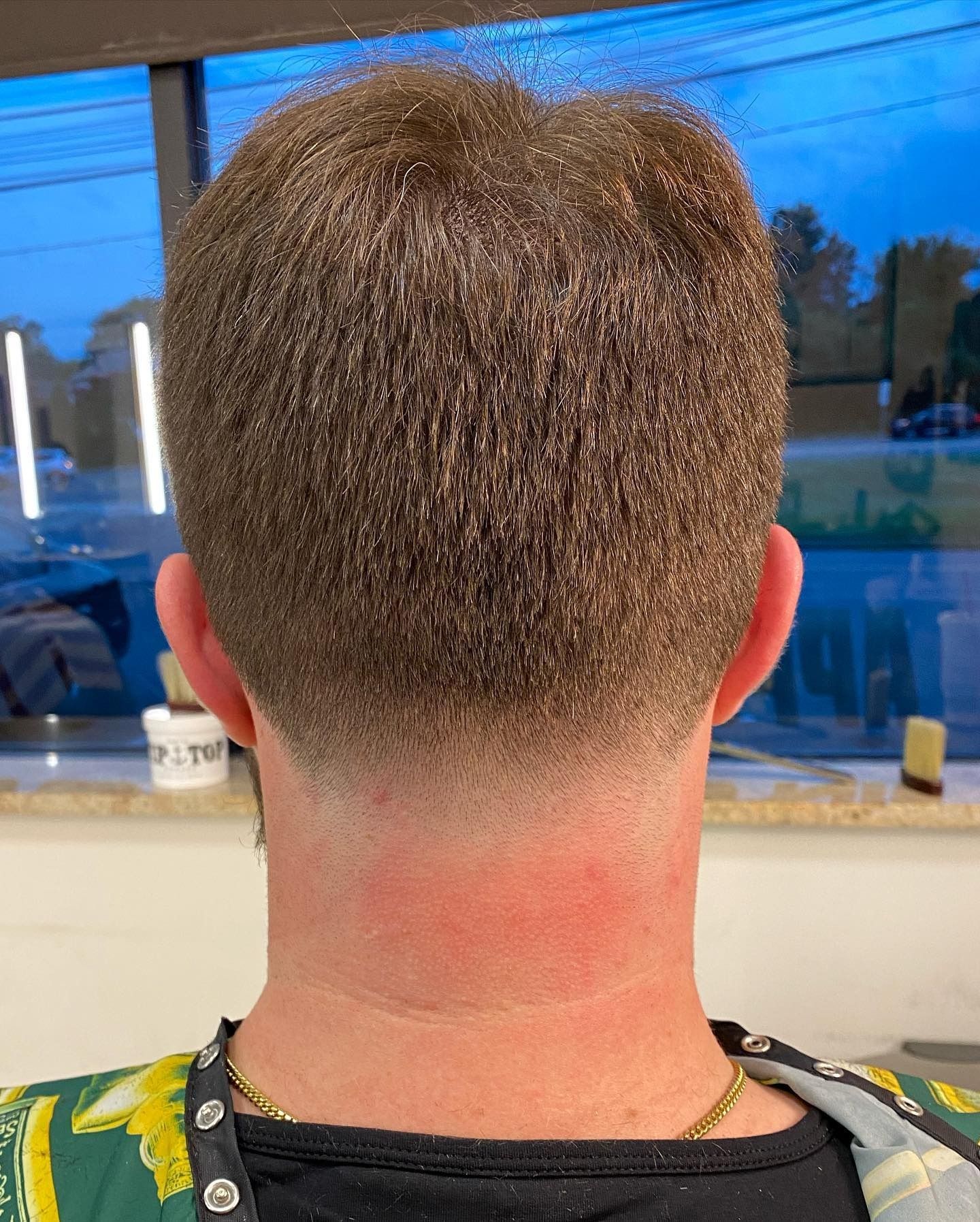 The back of a man 's head with a very short haircut.