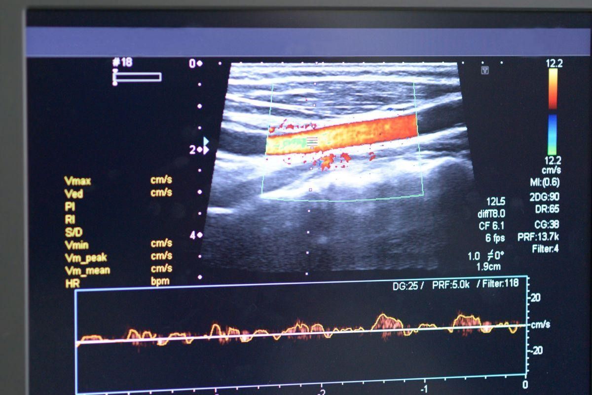 exame-vascular-foz-do-iguacu-cirurgia-vascular-foz-do-iguacu