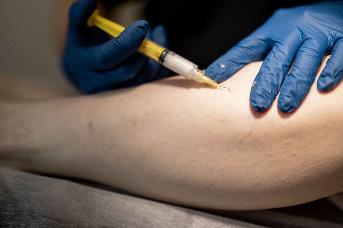 laser-transdermica-cirurgia-vascular-Vascullare-foz-do-iguacu