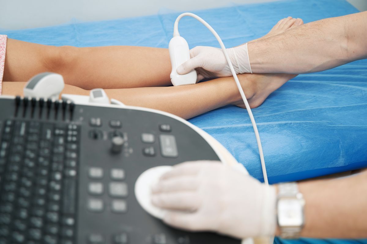 tratamento-para-varizes-vasinhos-vascular-foz-do-iguacu