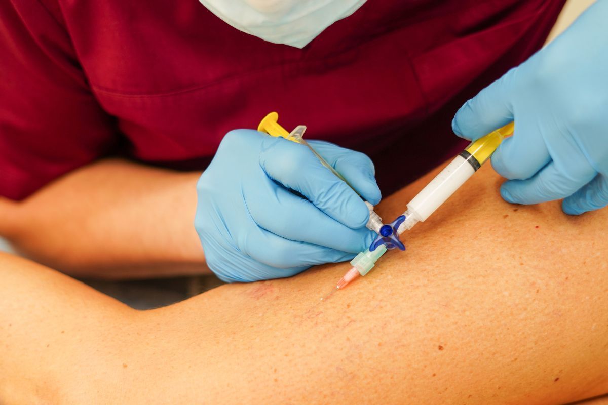 tratamento-varizes-clinica-Vascullare-cirurgia-vascular-foz-do-iguacu