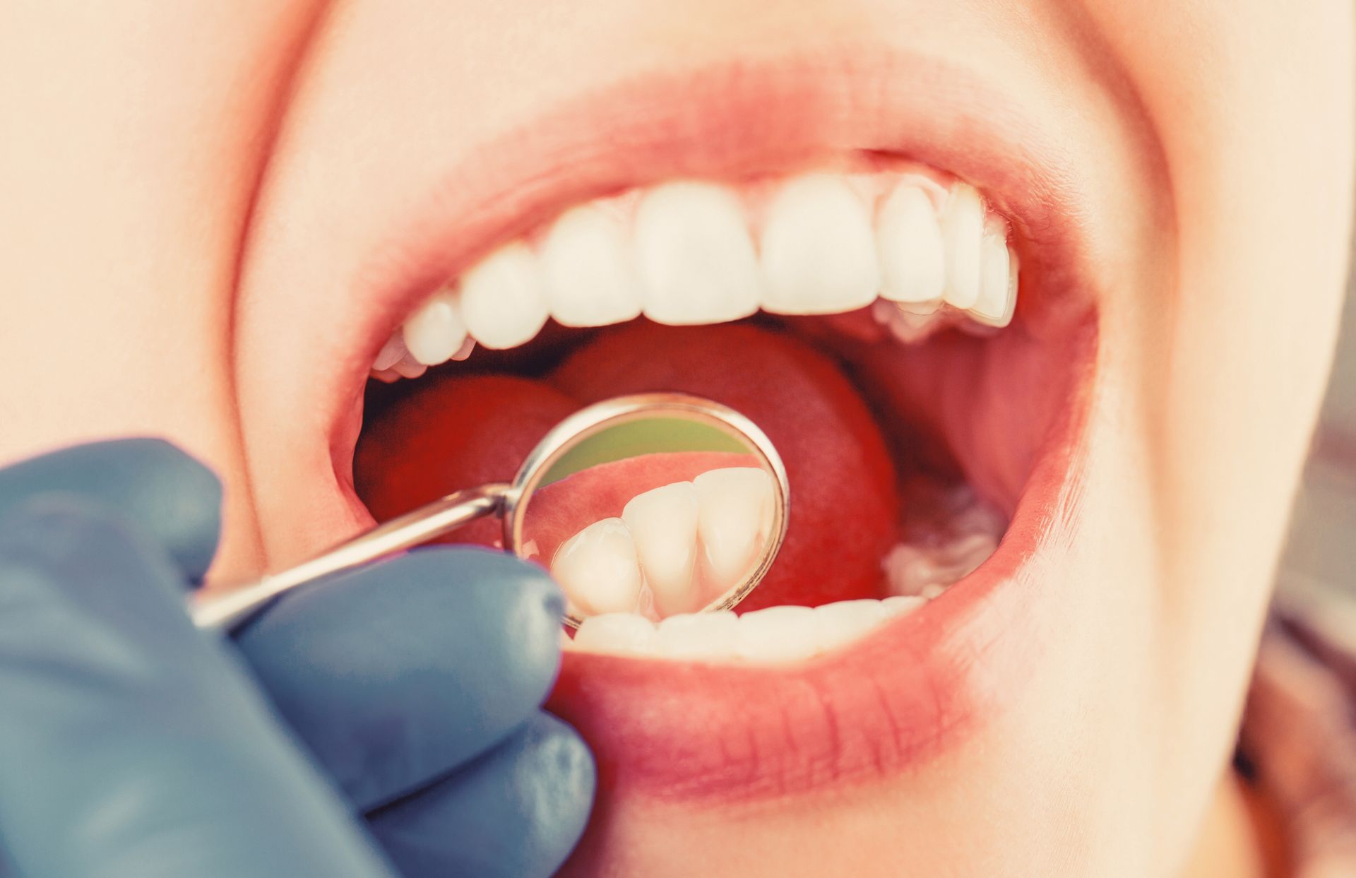 Dentist examining teeth with a mirror. Mouth open, teeth visible, red gums, gloved hand, close-up.