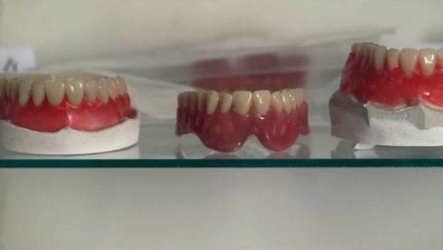 Três dentaduras estão em uma prateleira de vidro.