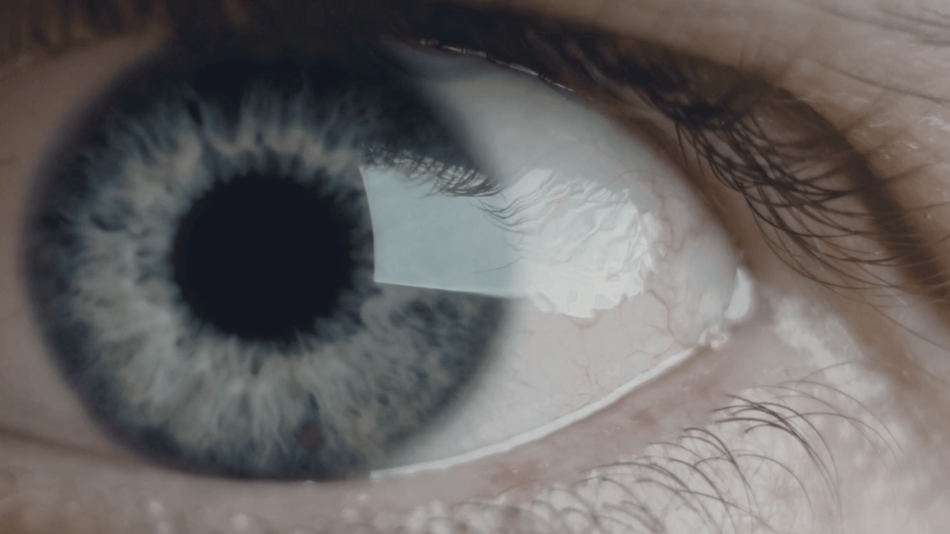 Um close do olho azul de uma pessoa com pupila branca.