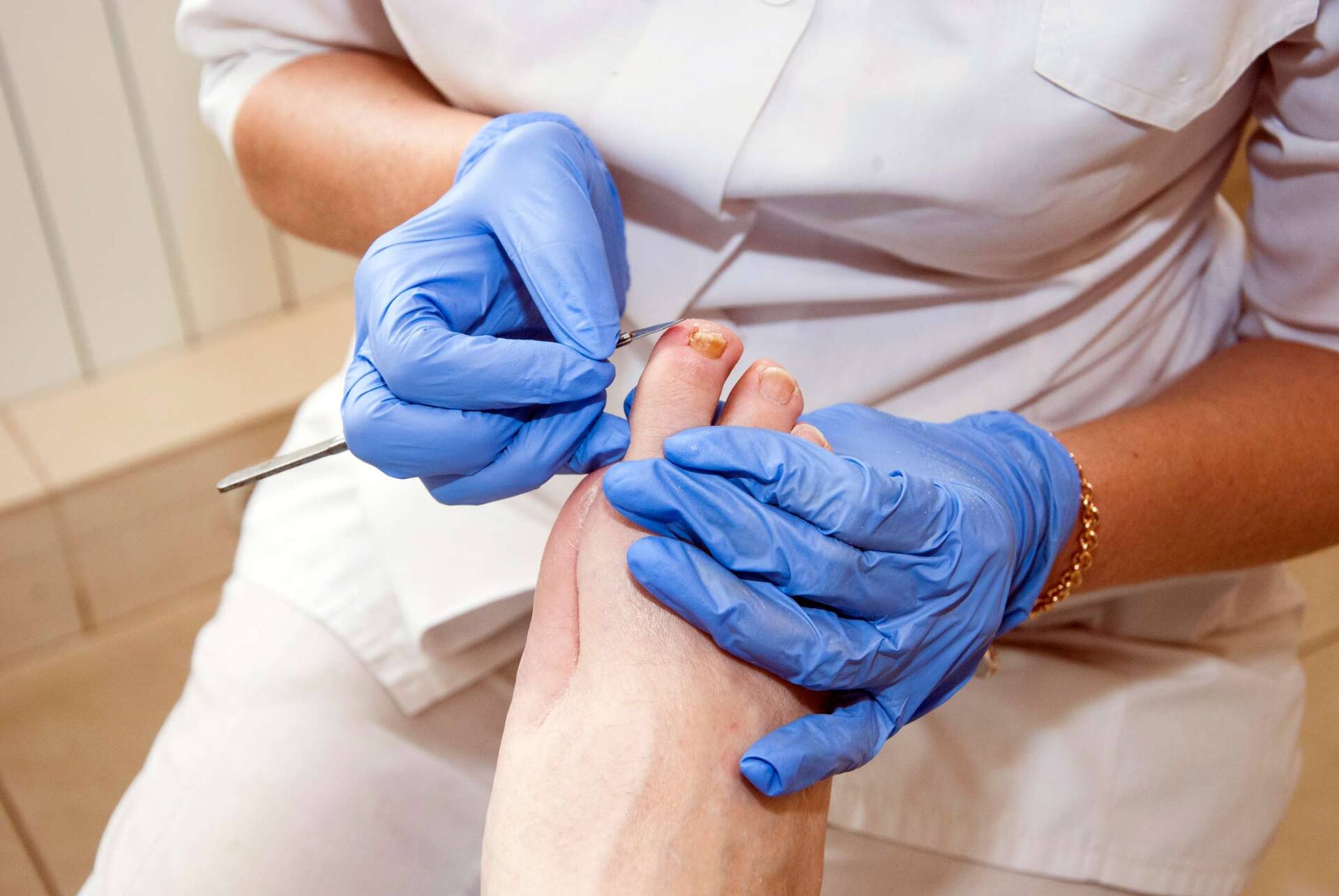 Diabetic Foot — Indianapolis, IN — Ladine Podiatry