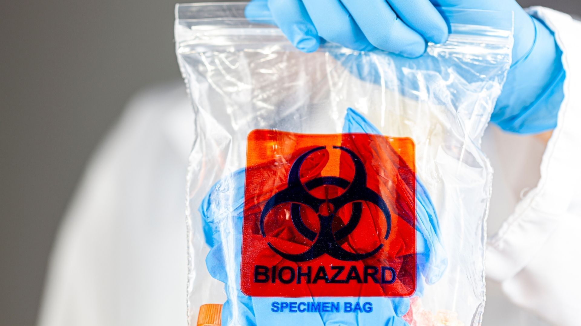 A person wearing blue gloves is holding a biohazard specimen bag.