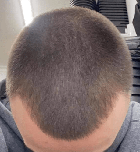stop and regrow australia client review - cleve 37 years old after