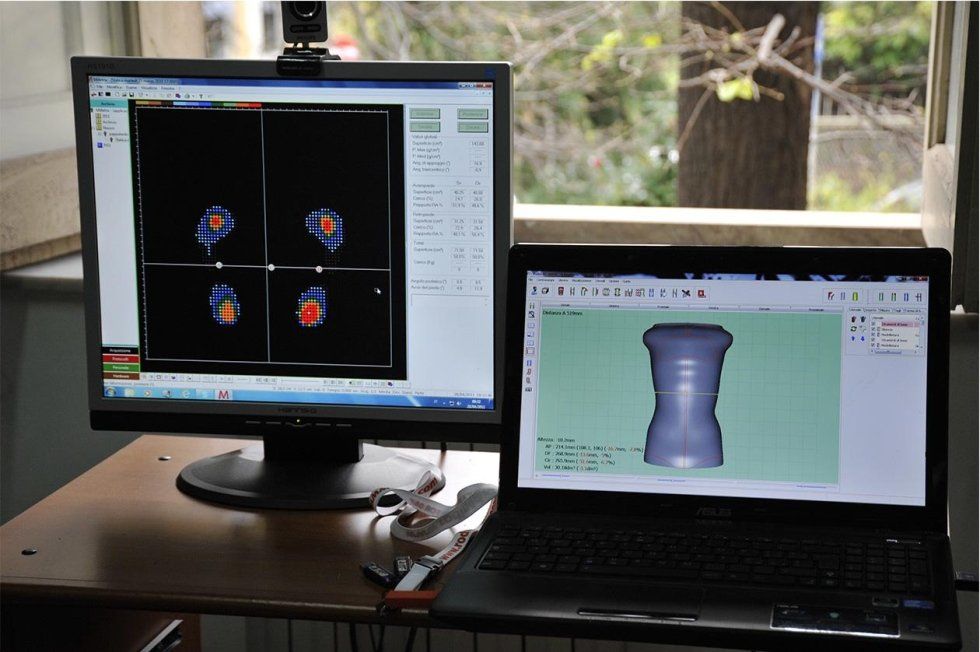 progettazione al computer di ausili ortopedici