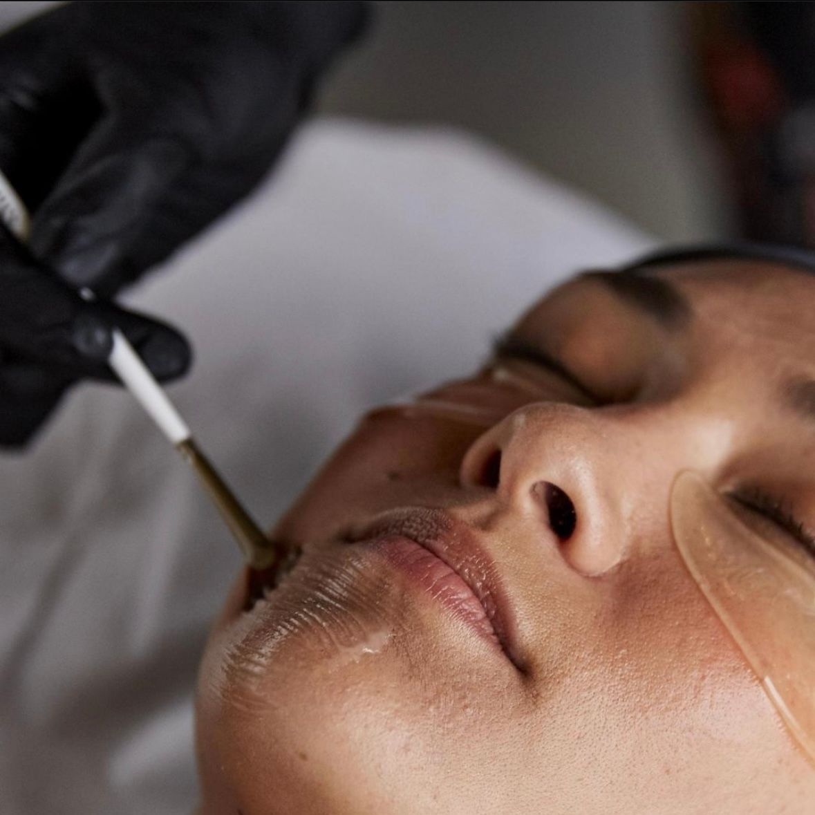 woman getting facial peel