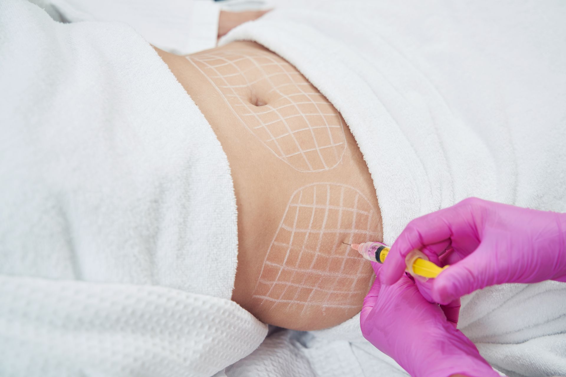 woman getting Fat Dissolving Injections