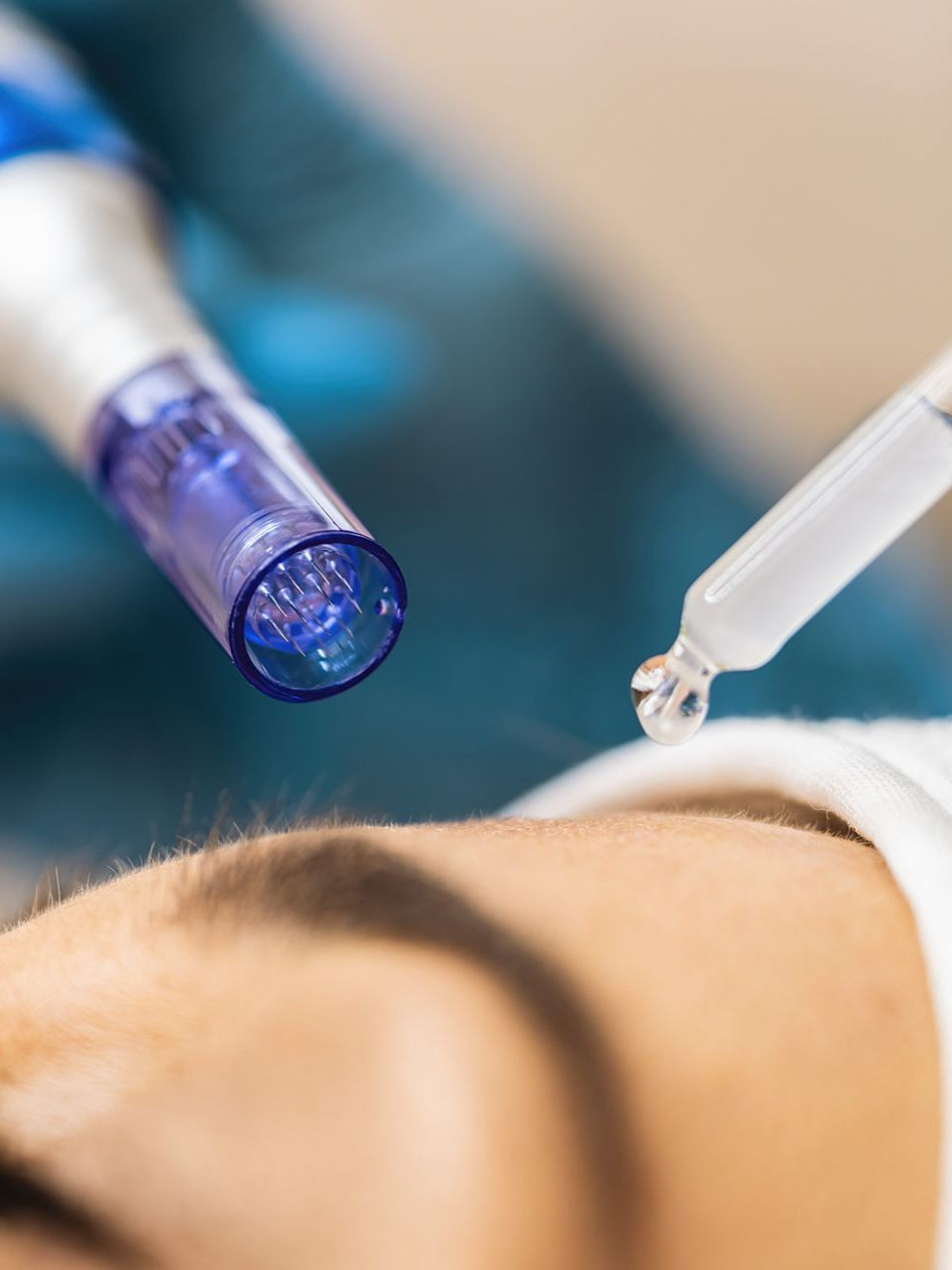 Close-up of a person's face receiving a microneedling treatment with a pen-like device and serum dropper.
