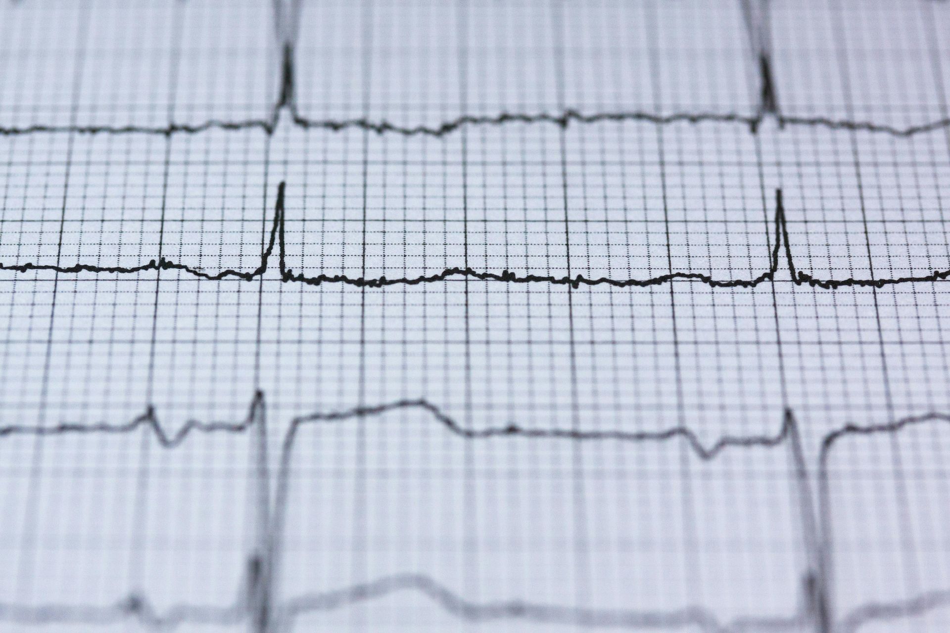 EKG, Hjärtscreening