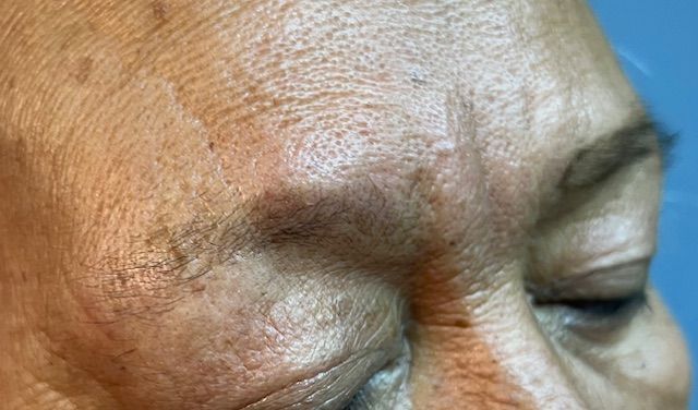 before eyebrow microblading