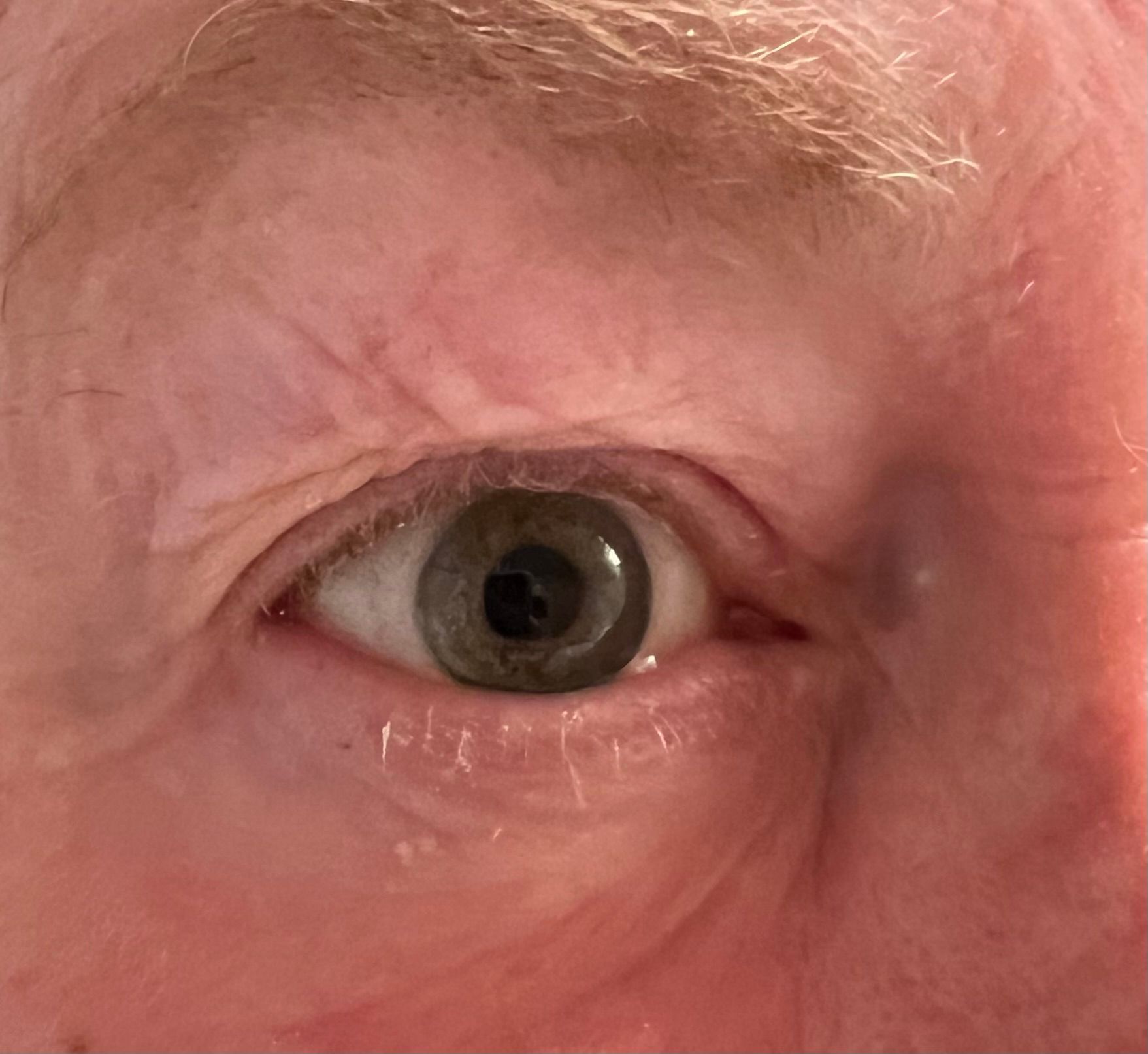 Close-up of a person's eyes, featuring light blue irises, light-colored eyebrows, and fair skin.