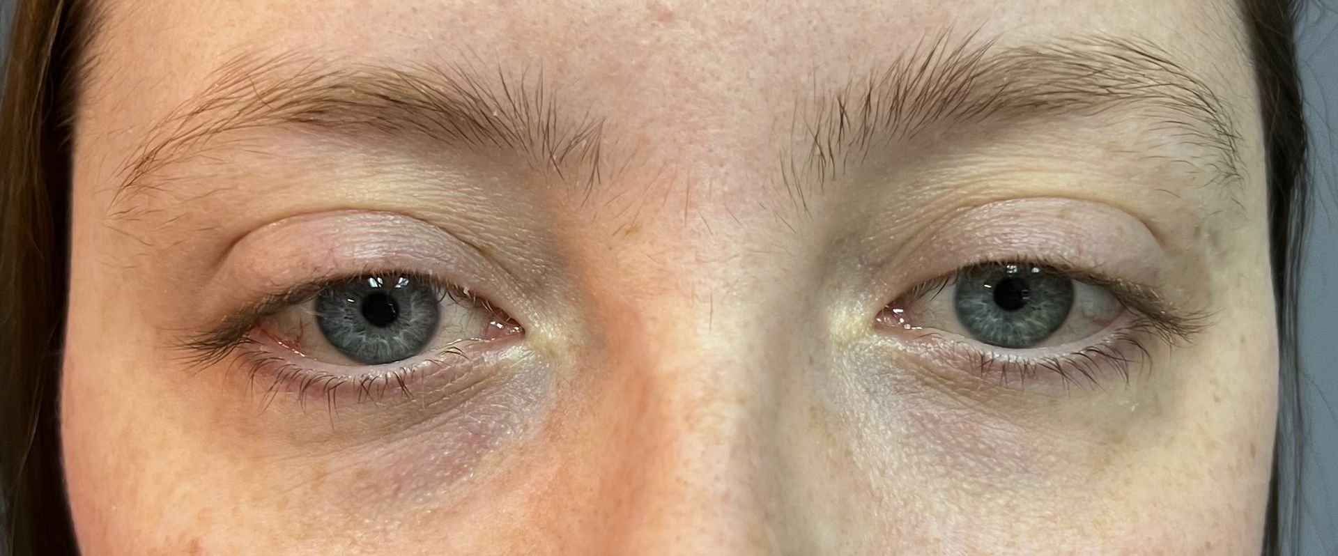 Close-up of a person's eyes, featuring light blue irises, light-colored eyebrows, and fair skin.