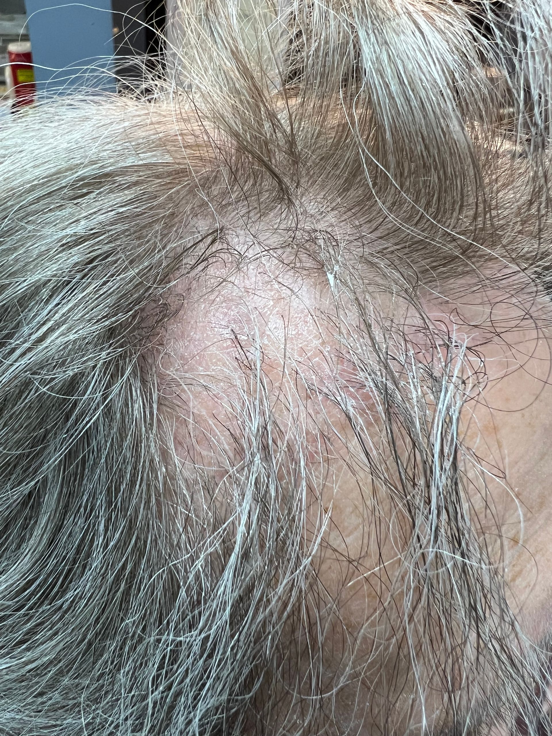 Before hair stimulation