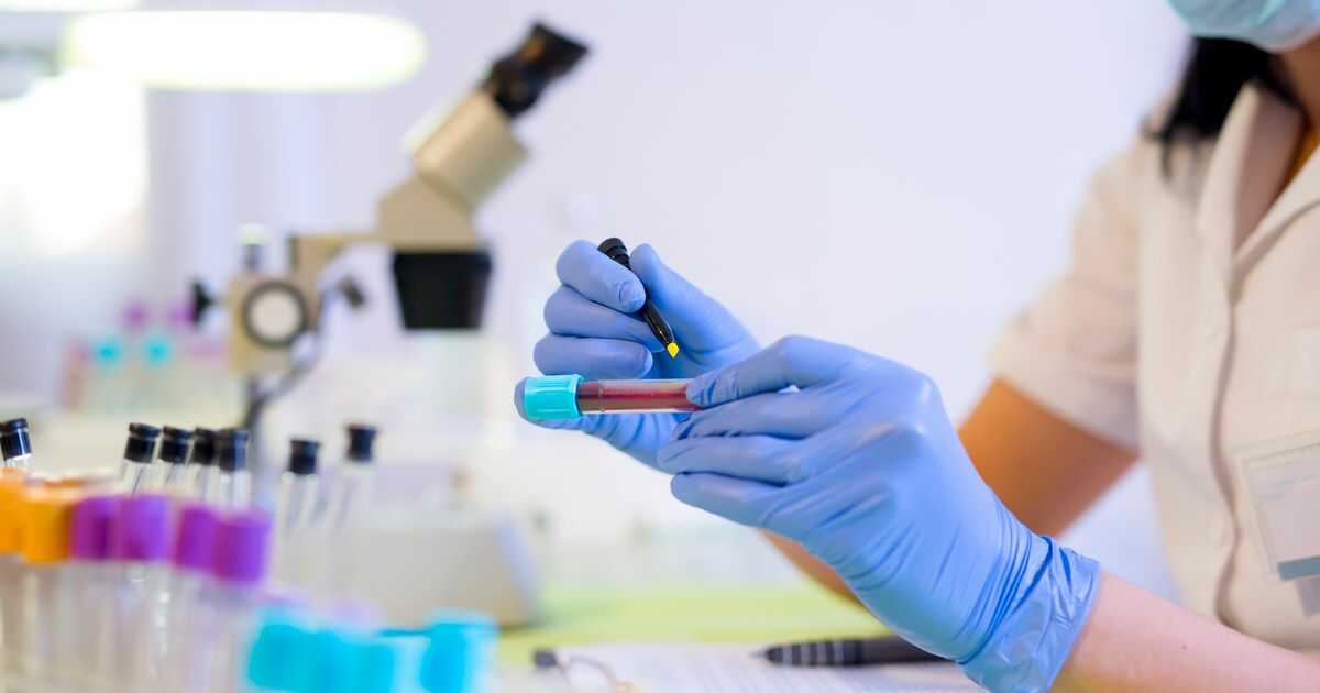 LABORATORIO DE ANALISIS CLINICOS SAGRADO CORAZÓN DE JESUS - Pruebas de embarazo