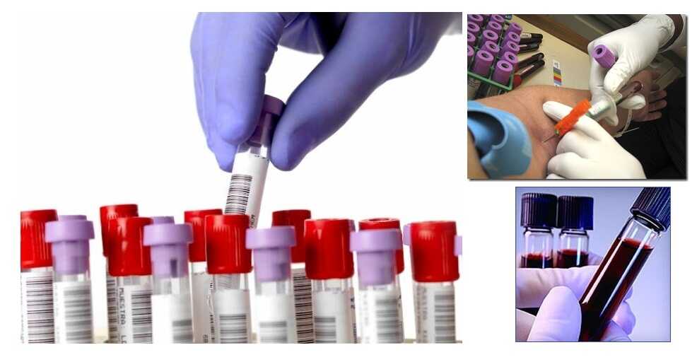LABORATORIO DE ANALISIS CLINICOS SAGRADO CORAZÓN DE JESUS - personal profesional y confiable