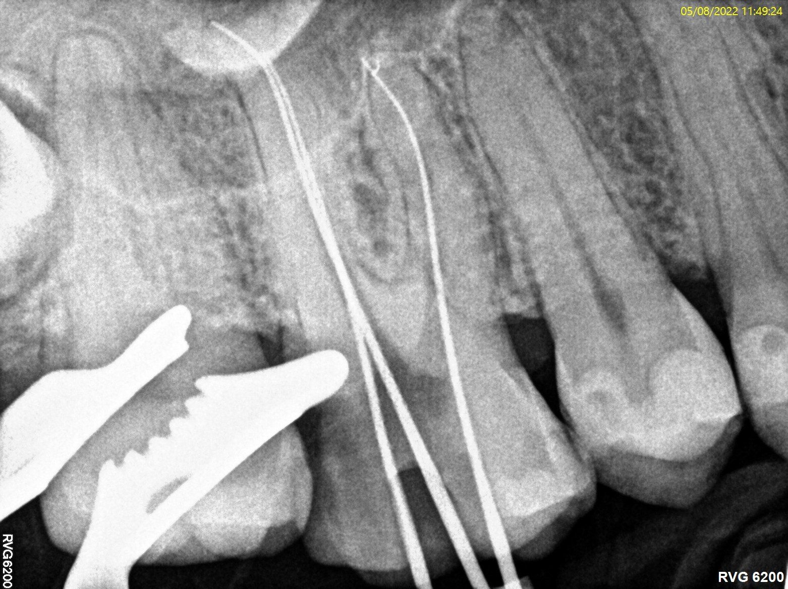 Endodonzia