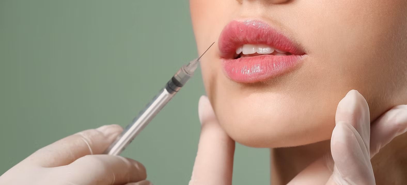 A person receiving a lip filler injection. A gloved hand holds the syringe towards the lips.