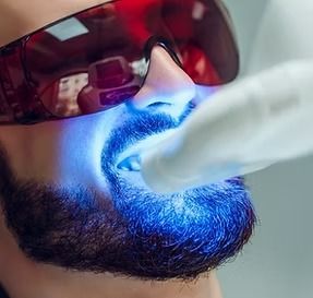 Man undergoing teeth whitening, illuminated by blue light. Red safety glasses, mouth open.