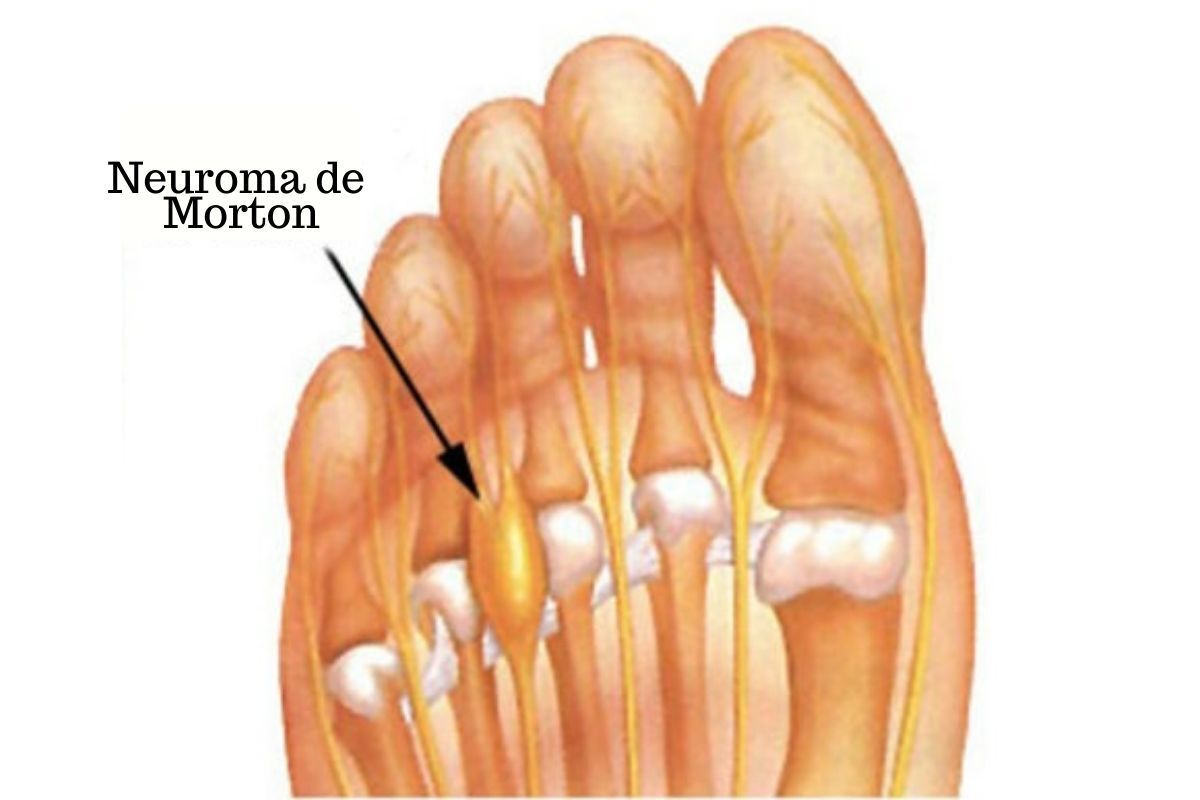 Dr-ivan-giarola-ortopedista-pe-sao-paulo