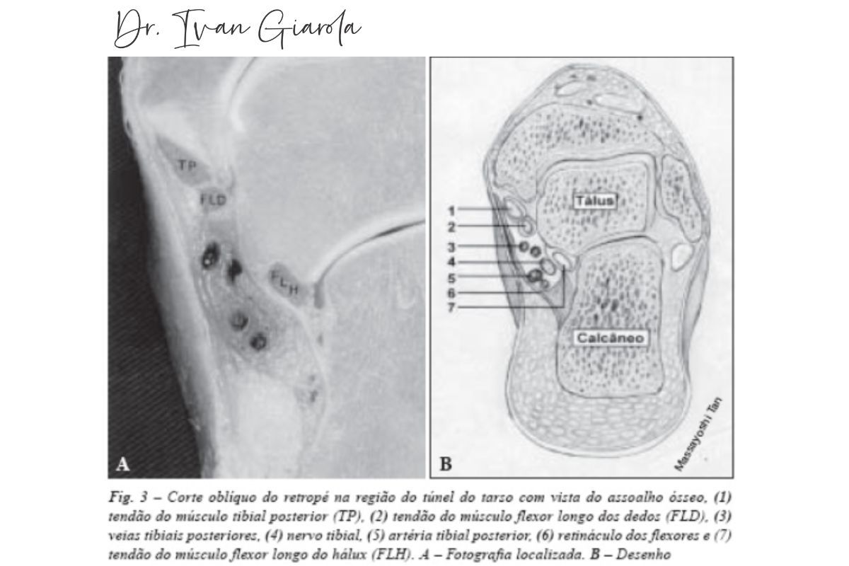 anatomia-tunel-tarso-dr-ivan-giarola-ortopedista-tornozelo-sao-paulo