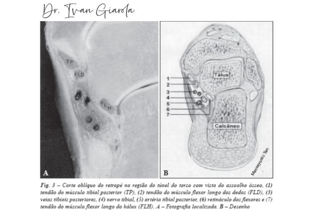 Anatomia Do Tarso Anatomía Del Tarso Caninos Medicina Veterinaria