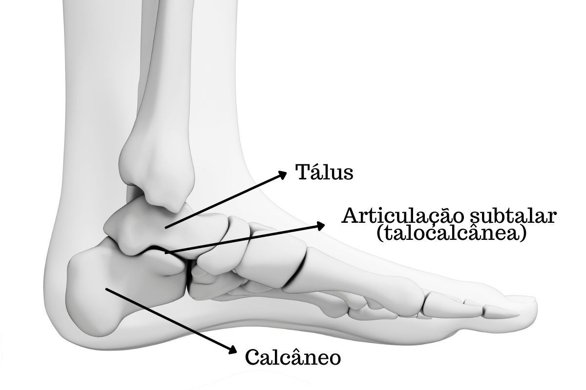 fratuura-calcanhar-dr-ivan-giarola-ortopedista-especialista-pe-tornozelo