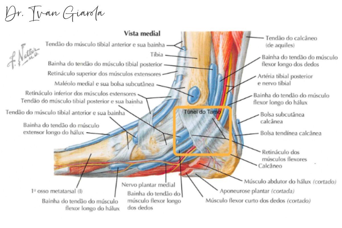 tunel-tarso-dr-ivan-giarola-ortopedista-tornozelo-sao-paulo