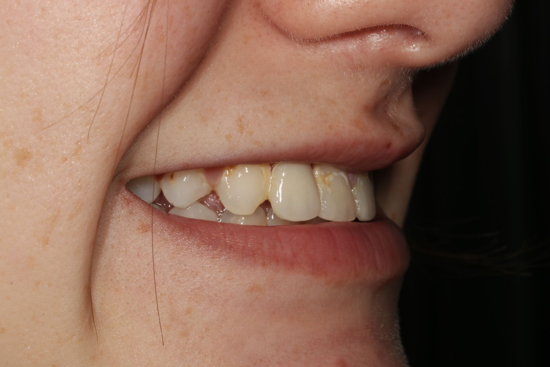 A close up of a woman 's teeth with a black background.