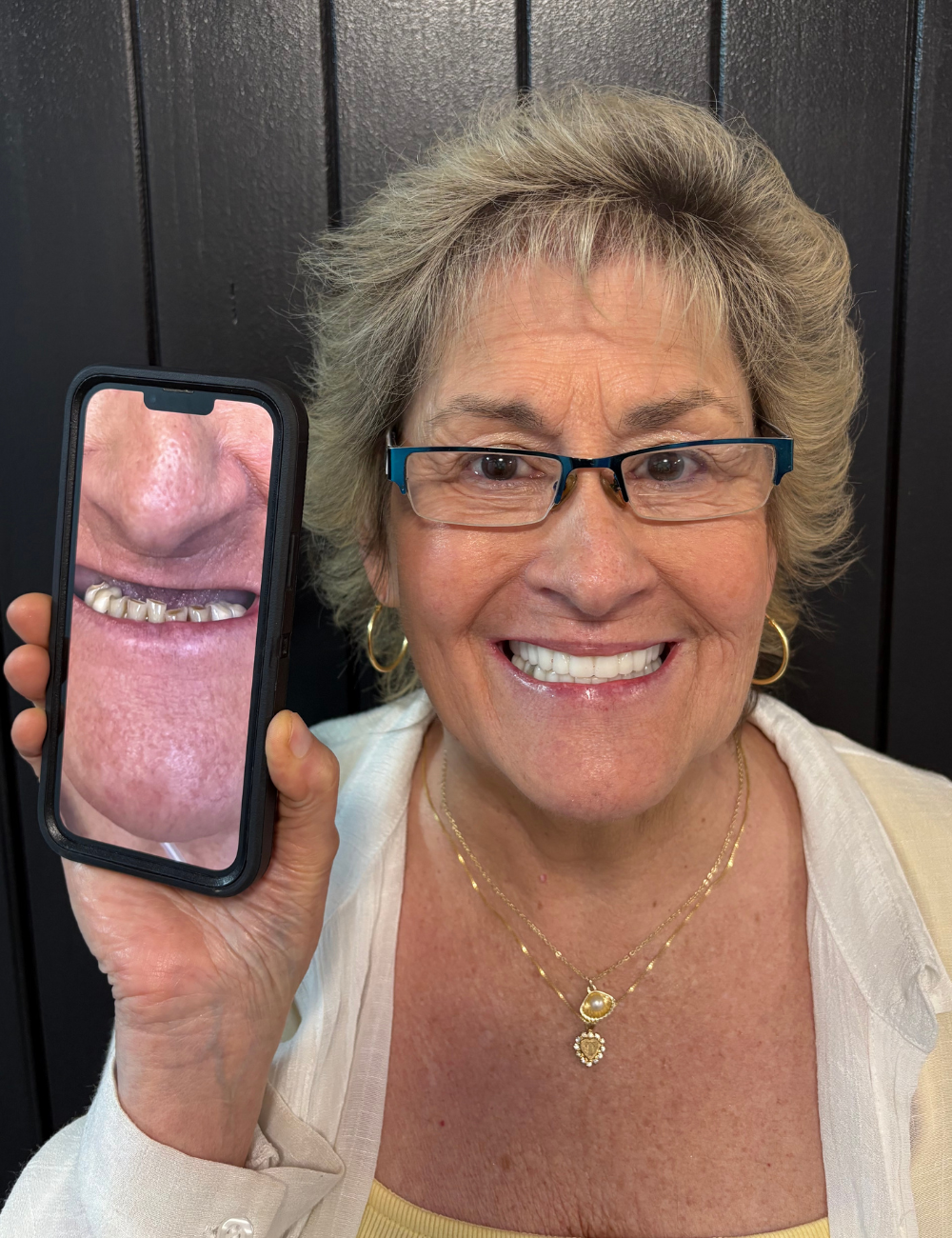 Woman holding a phone displaying a photo of her teeth before a dental procedure. She smiles broadly.
