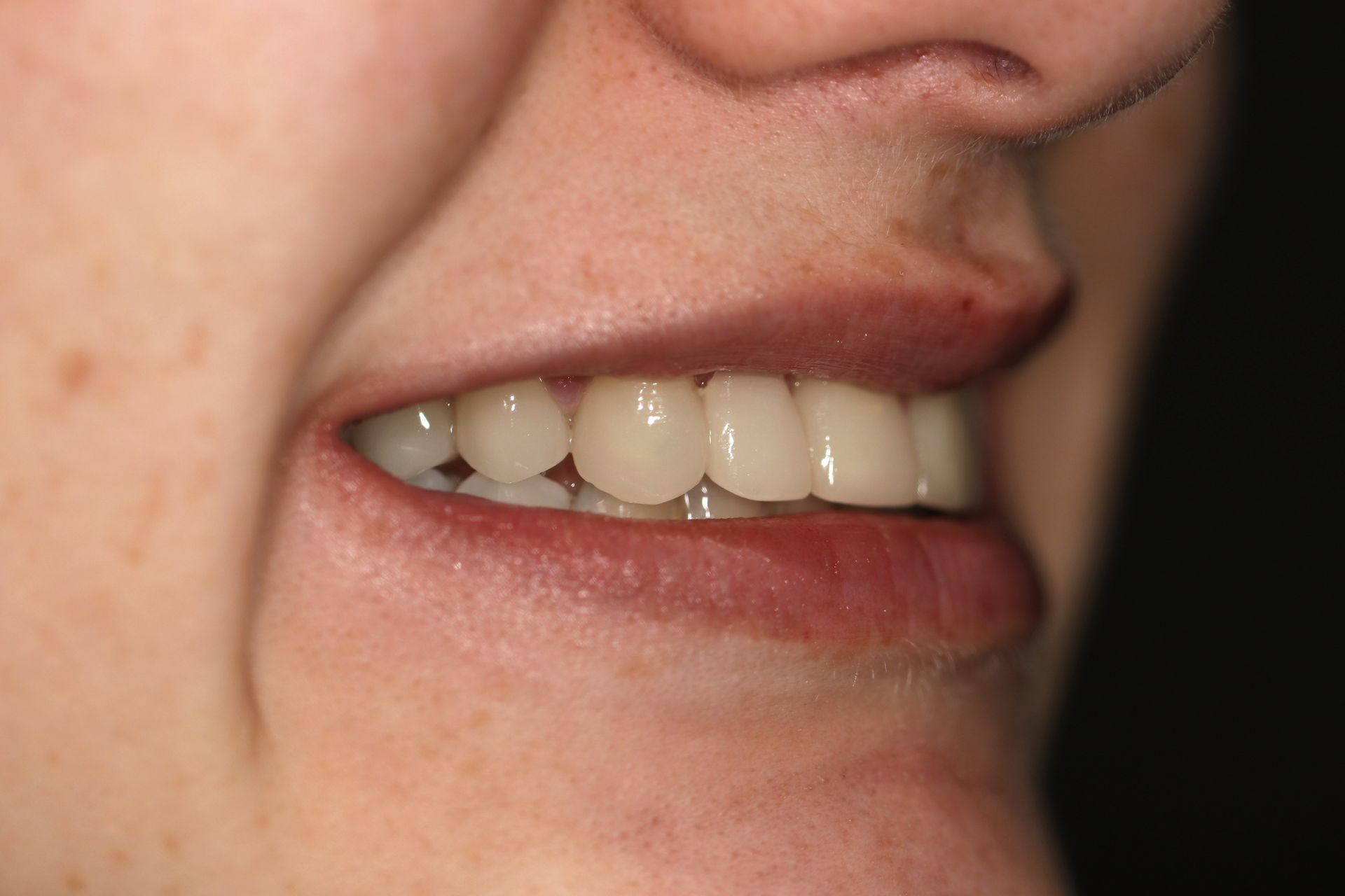 A close up of a woman 's mouth with white teeth and red lips.