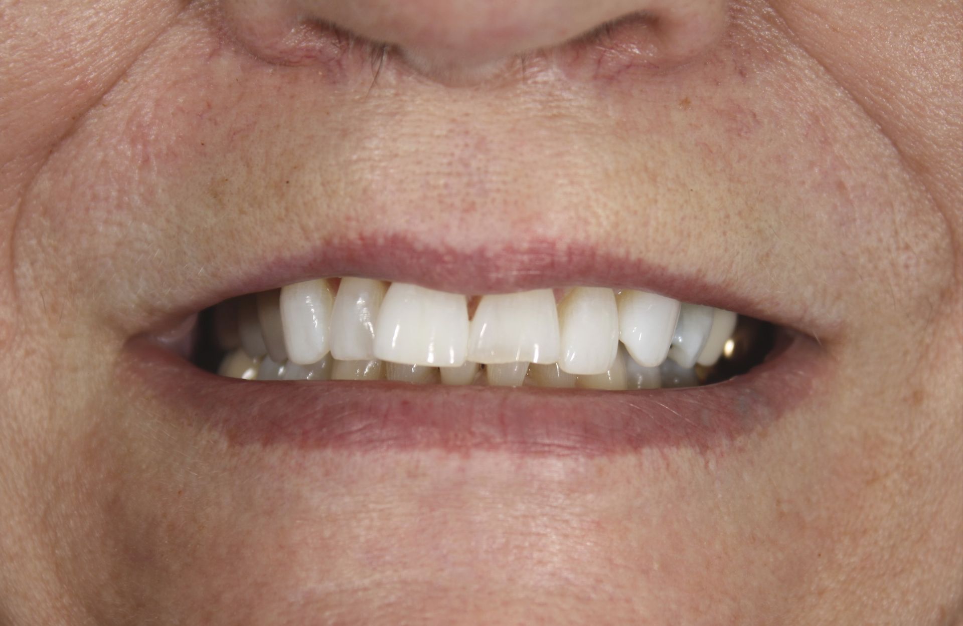 A close up of a man 's face with a beard and a smile.