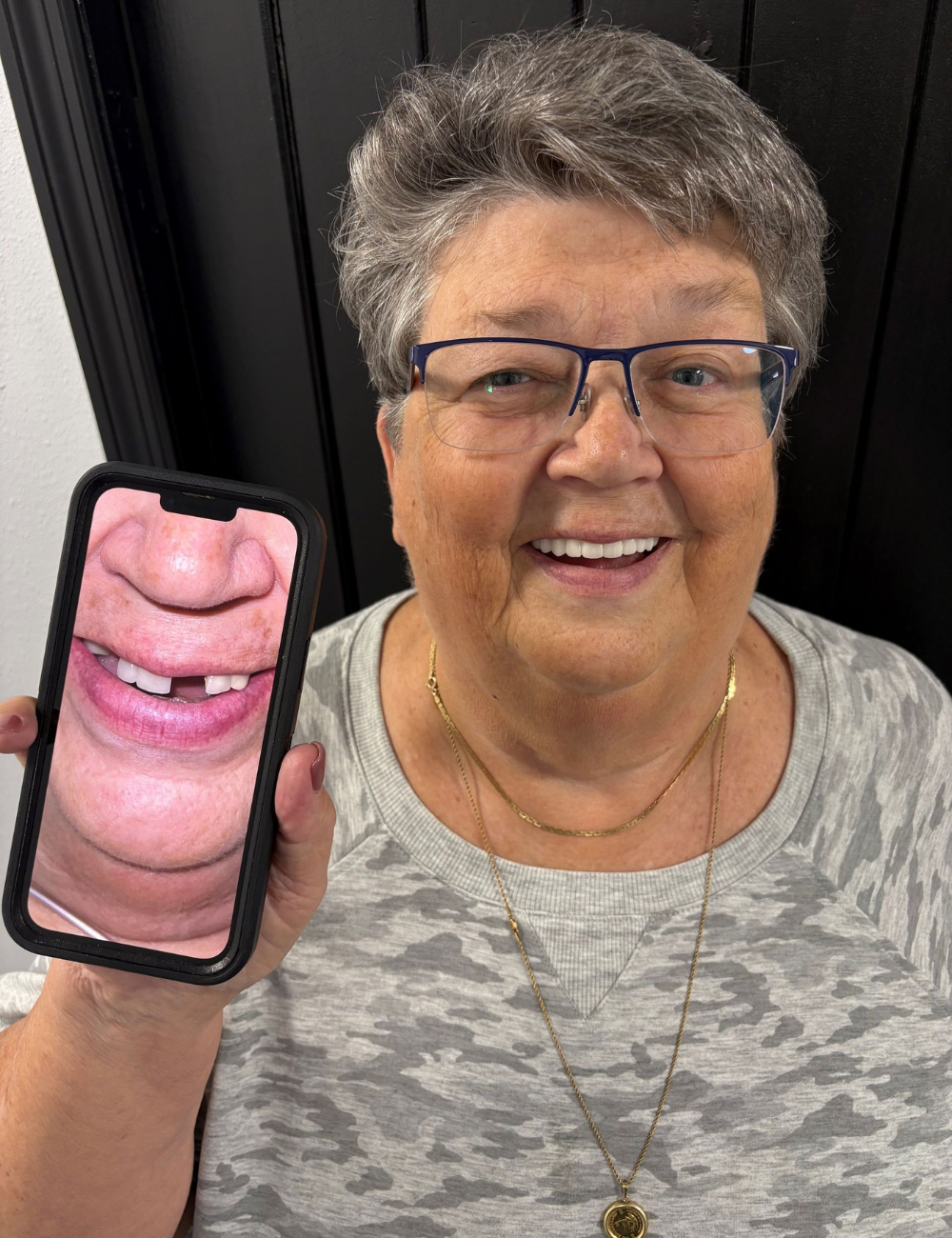 Woman holding phone displaying a close-up of a toothless mouth, smiling, wearing glasses and a gray patterned shirt.