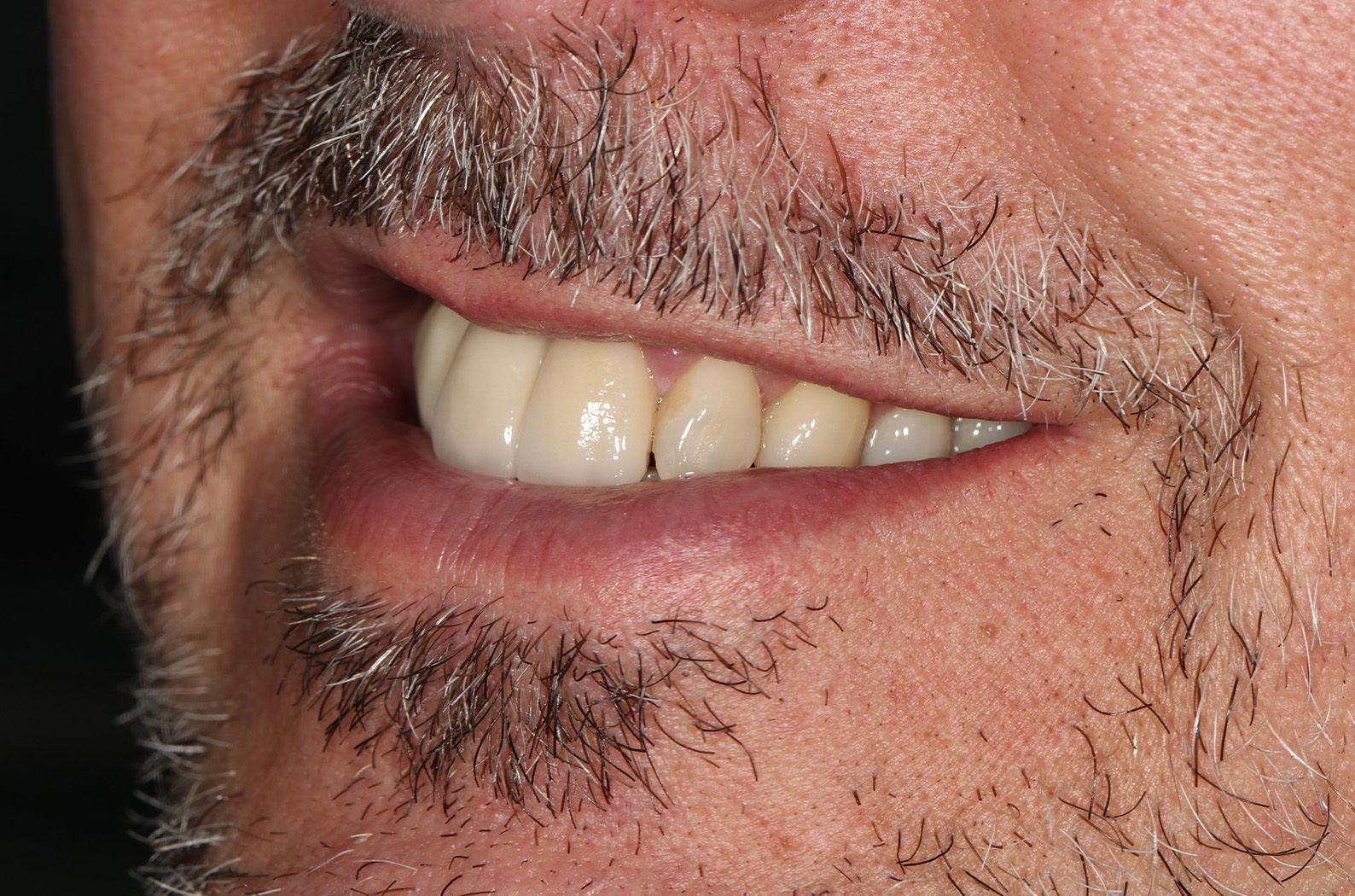 A man with a beard and white teeth is smiling.