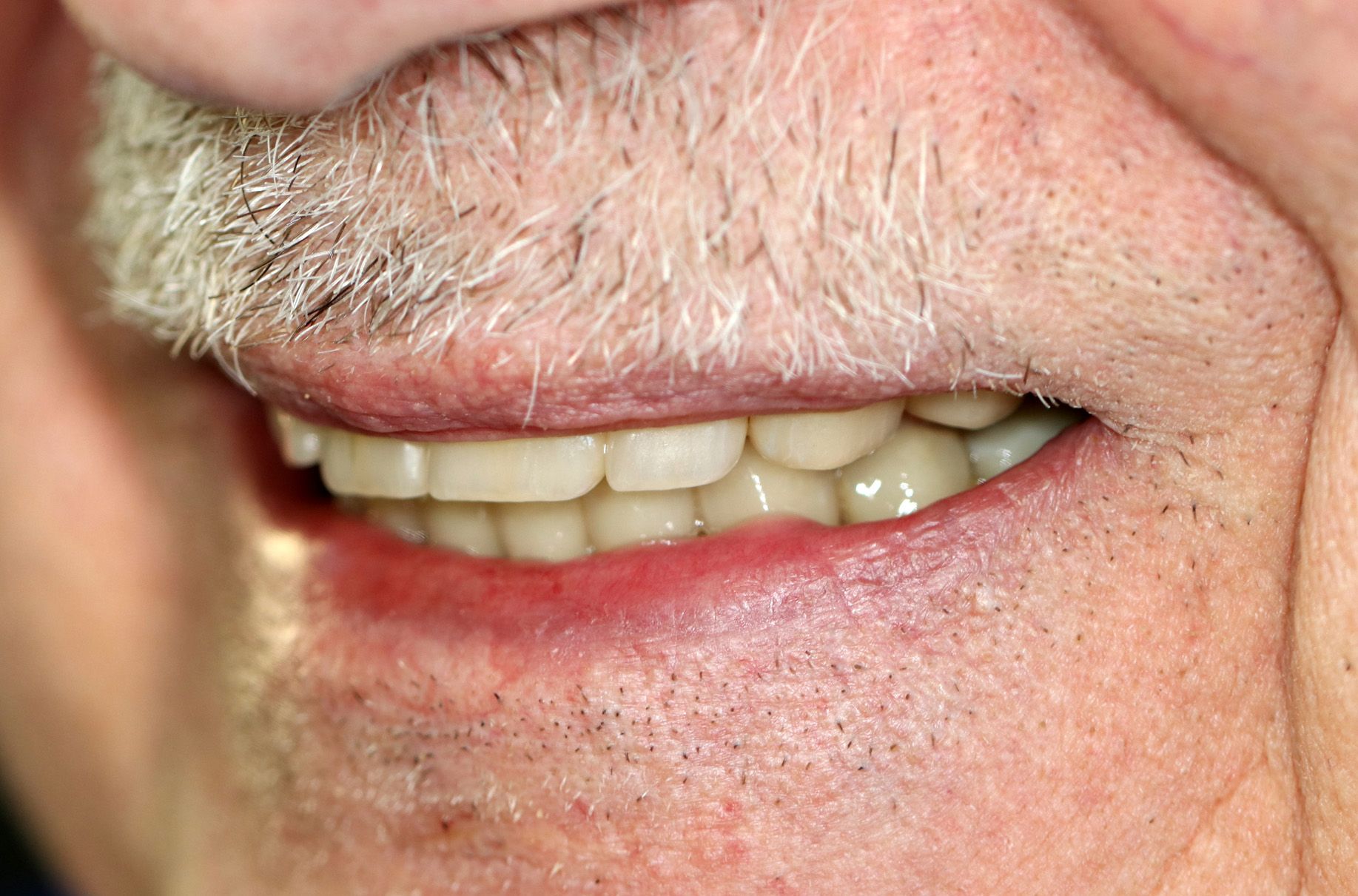 A close up of a man 's mouth with a beard and teeth.