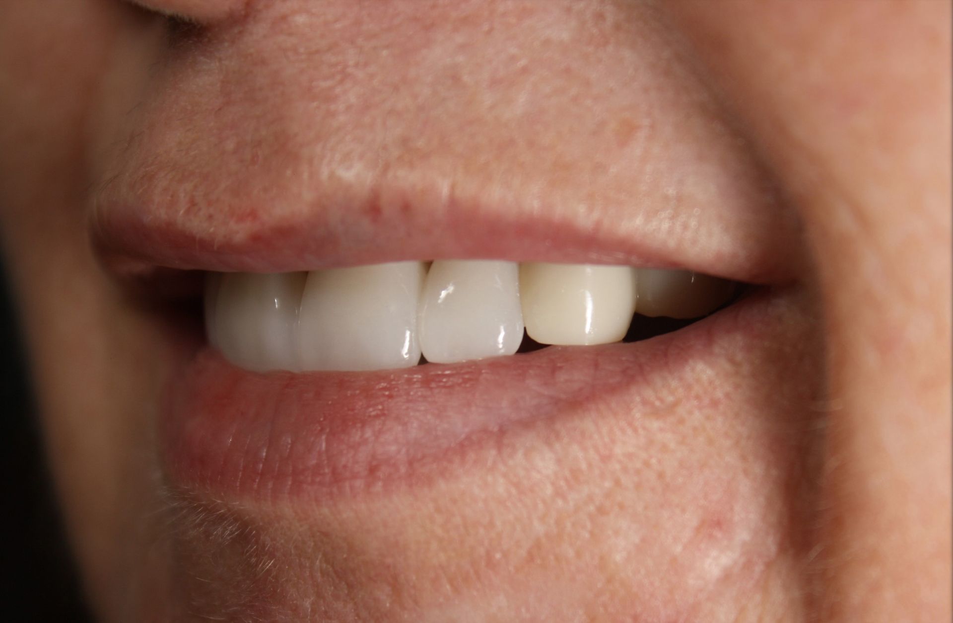 A close up of a person 's mouth with white teeth.