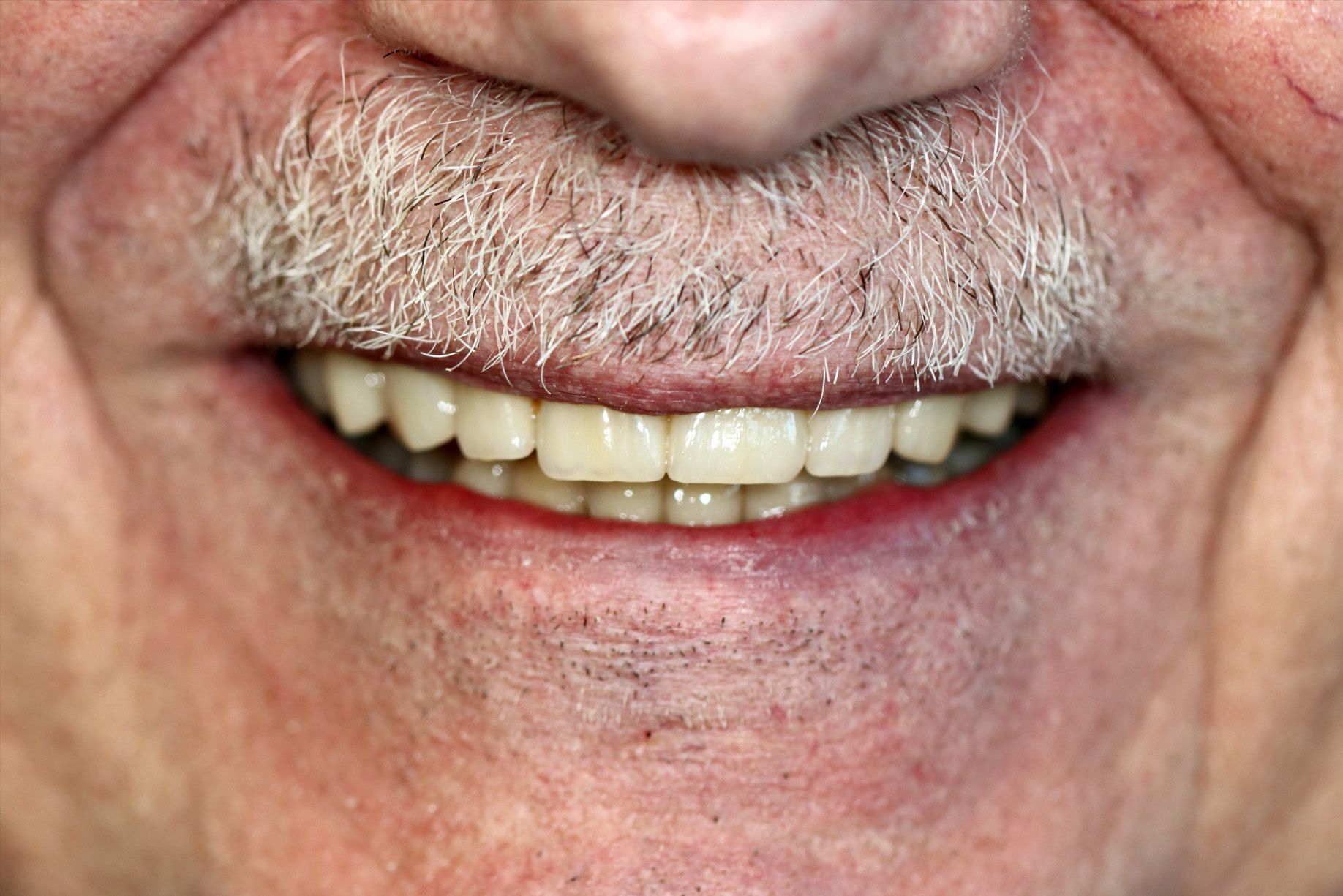 A close up of a man 's face with a beard and a smile.