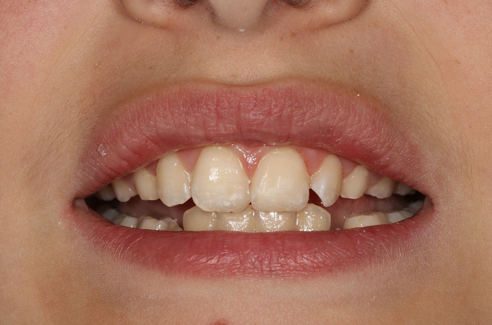 A close up of a person 's mouth with white teeth and red lips.